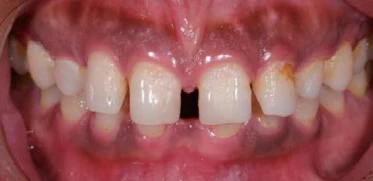 product-373-181